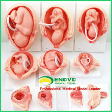 ANATOMY13(12451) Natural size 10in1 Development Process for Fetus, Anatomy Models > Pregnancy Models 12451